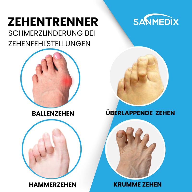 [Australia] - Sanmedix toe separators for all toes - 3 pairs / 6 pieces. Silicone toe separators for men and women - toe extension correction set against hallux valgus, bunions, hammer toes black 