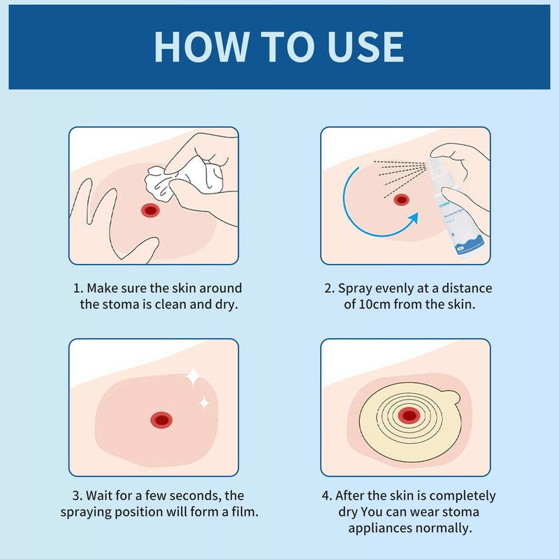 [Australia] - No Sting Ostomy Barrier Spray - Skin Barrier Film for Sensitive Skin - Skin Barrier for Protection Around Stomas and Wounds 