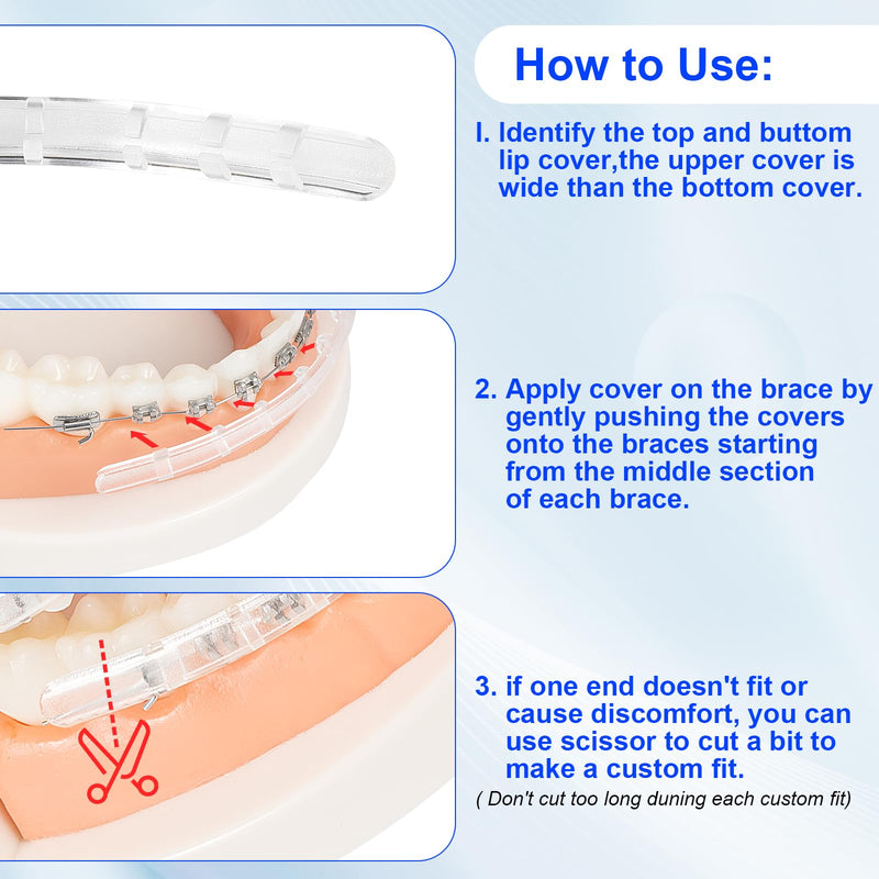 [Australia] - Comfort Cover for Braces - Lip Protector, Orthodontic Lip Cushion, Mouth Guard Clear Teeth Shield Bumper for Brackets, Aligner, Dental Wax Alternative, in Portable Storage Case with Mirror 