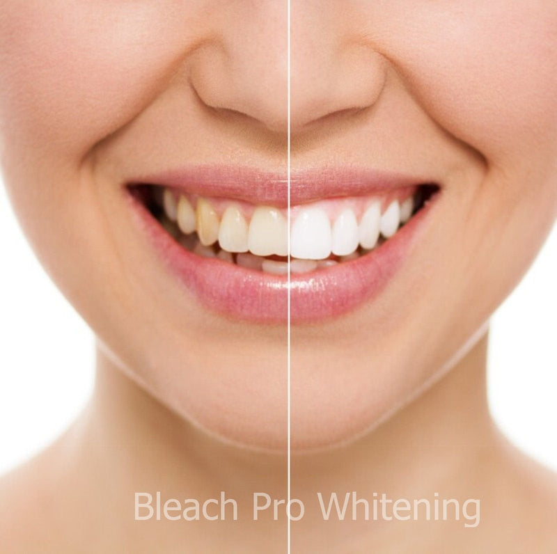 [Australia] - Teeth Whitening Gel Syringe 10ml Dispensers 44% Carbamide Peroxide Tooth Bleaching 4 Pcs 