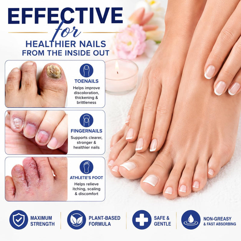 Nail Renewal Treatment Extra Strength: 25% Undecylenic Acid OTC Formula – Toenail Nail Care Kit with Brush & File for Ingrown Nails, Discoloration & Brittle Nails, Thick-Looking, Rough-Looking