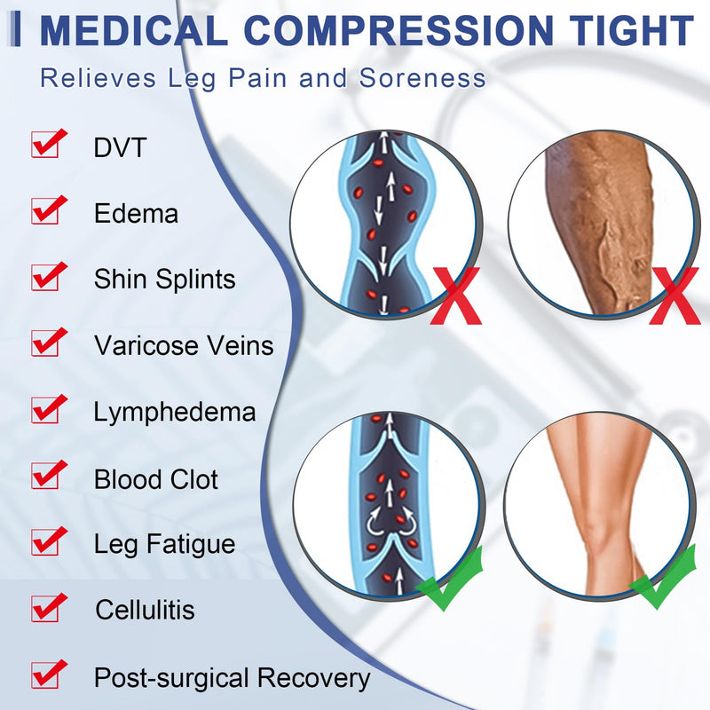 [Australia] - beister Medical compression stockings for women, long, 20-30 mmHg, support stockings for men, opaque toe-free compression trousers, class 2, solid support for varicose veins, edema, black M 