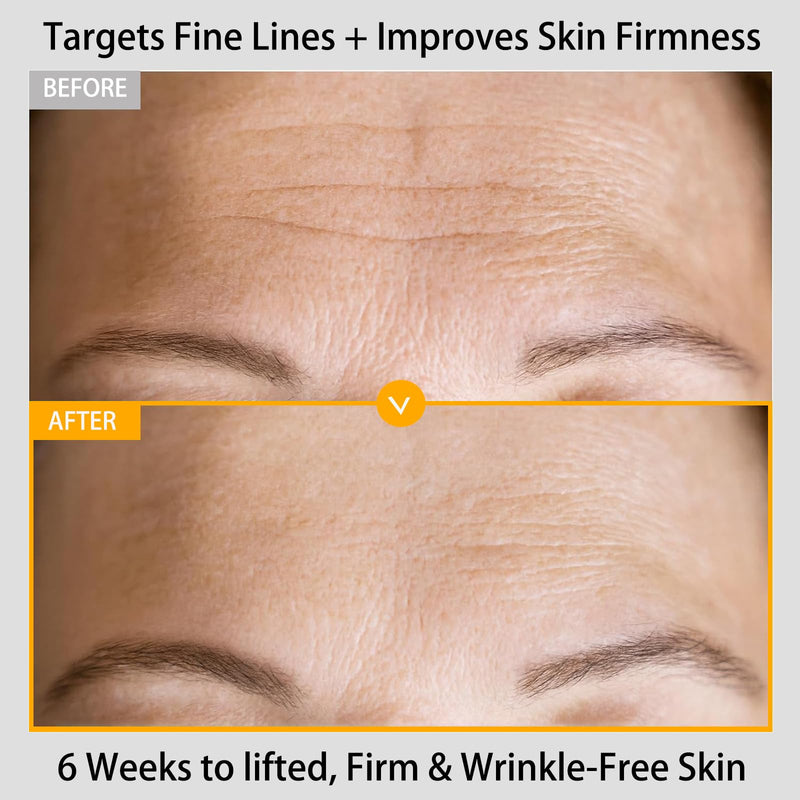 Vitamin C Retinol Serum for Face, Brightening & Anti-Aging with Hyaluronic Acid, Vitamin E, Peptides, Collagen - Hydrates, Firms, Lifts, Smooths, Targets Age Spots, Wrinkles, 1.7 Fl Oz