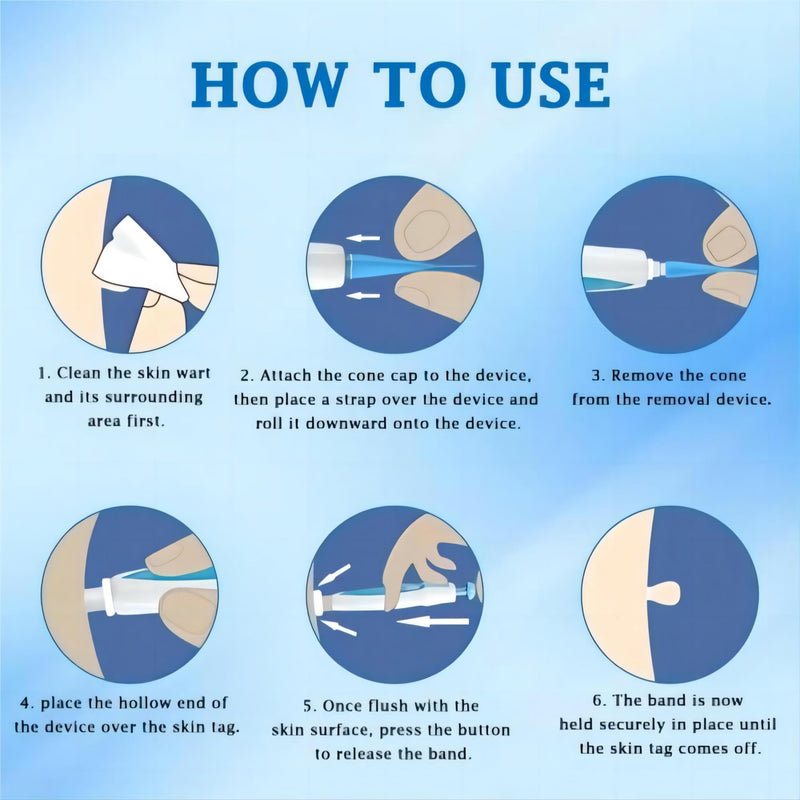 [Australia] - Micro Skin Tag Remover, Skin Tag Birthmark Remover, Auto Skin Tag Remover Kit, Stalk Wart Removal Quick Kit, Skin Tag Removal Pen, Wart Remover for Micro to Large (1-8 mm) 