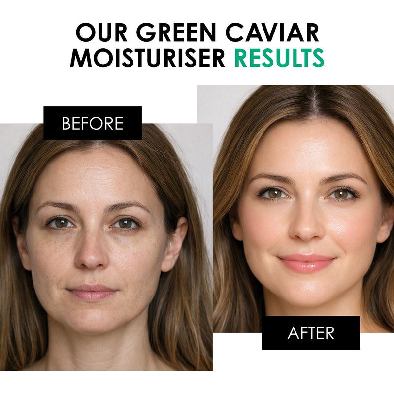 skinChemists Green Caviar Night Face Moisturizer | Overnight Repair Cream for Dull, Dry Skin | Helps Smooth, Hydrate & Restore Glow (Day Cream) Day Cream