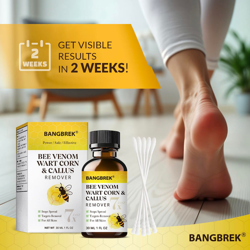 [Australia] - Bee Venom Wart Remover: 7x Fast Acting Wart Remover Freeze Off for Plantar Common Flat Wart Corn Callus Removers for Toes Feet - Maximum Strength Salicylic Acid Wart Corn Callus Removers (1 Fl Oz) 1 Fl Oz (Pack of 1) 