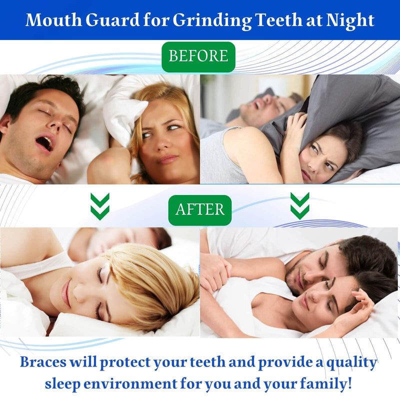 [Australia] - Mouth Guard for Grinding Teeth at Night, 4 Pcs Mouthguards for Grinding of Teeth, Moldable Night Mouth Guards for Teeth Grinding, Nightguards for Grinding Teeth, Night Guards for Teeth Grinding 