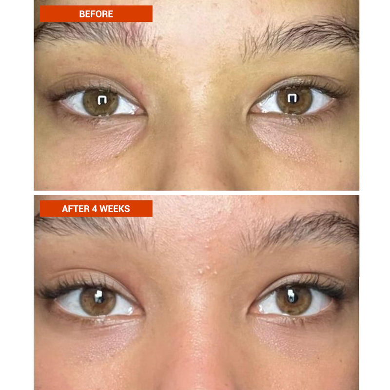 BeautyStat Vitamin C Eye Cream - Caffeine Eye Perfector for Dark Circles | 5% Vitamin C Under-Eye Cream with Caffeine - Reduces Puffiness & Circles 1