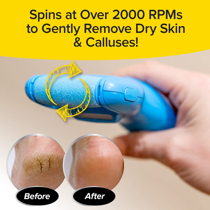 [Australia] - PedEgg Power Cordless Motorized Callus Remover w/ Bright LED Light As Seen On TV, Quickly Removes Calluses & Dry Skin w/ 2000 RPMs of Spinning Action for Smooth, Soft Feet, Easy-Grip Ergonomic Handle 