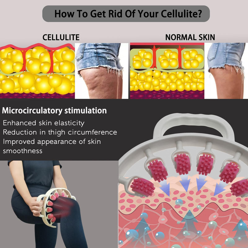 [Australia] - Anti-Cellulite Massage Roller, Lymphatic Drainage Massager Roller, Fascia Roller for Legs, Thighs, Waist, Buttocks, Deep Tissue Massage Roller for Legs, Pain Relief, Body Sculpting, Anti-Cellulite 