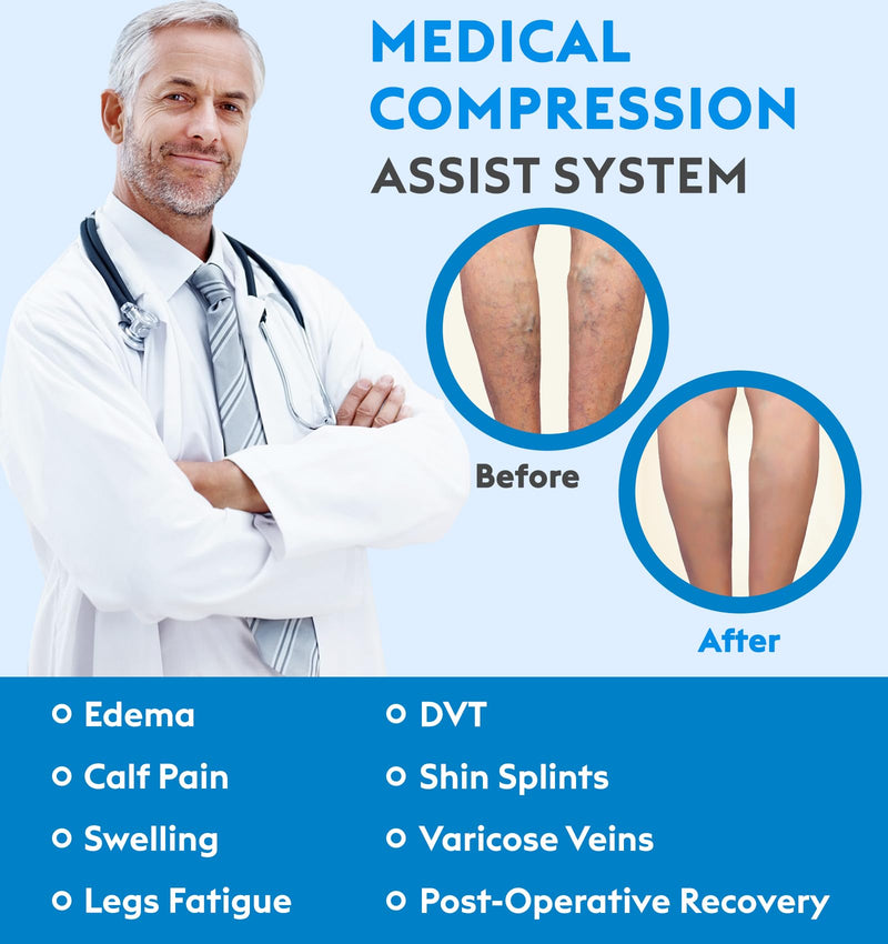 [Australia] - MGANG® Short Length 20-30 mmHg Compression Stocking for Men and Women, Reduced Length, Open Toe, Opaque, Support Hose for Varicose Veins, Edema, DVT, Pregnancy, Beige X-Large Short Length Beige 