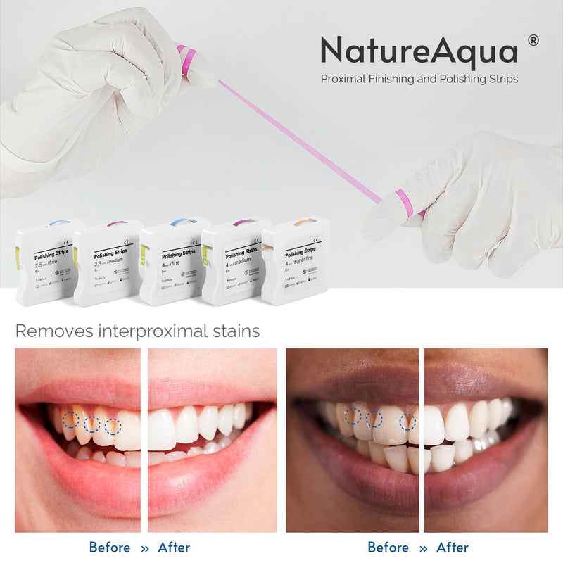 [Australia] - Tooth Sandpaper, Dental Polishing Strips, Size - 2.5mm Width - 6M/Rolls/Box, NatureAqua Resin Tooth Polishing Interdental Grinding Tool (Pink) Pink-2.5mm Width 