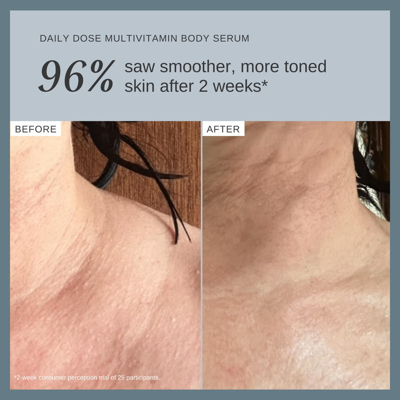 Alpha-H Daily Dose Multi-Vitamin Body Serum - 5% Niacinamide (150ml) | Multi-Vitamin Serum Brightens, Smooths & Hydrates the Body, Fast-Absorbing, Lightweight Daily Formula, Australian Made