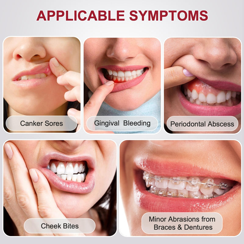 [Australia] - Oral Rinse Mouthwash - Mouth Rinse Help Canker Sores & Gingival Bleeding Treatment - Fresh Mild Mint (100ml/3.4 Fl oz) 