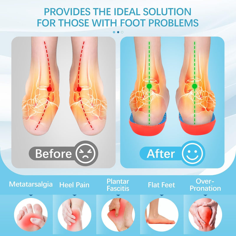 [Australia] - 2 pairs of orthopedic insoles, Comfysole heel spur insoles for bunions, plantar fasciitis, men and women, to support the arch of the foot, foot pain 41-42 