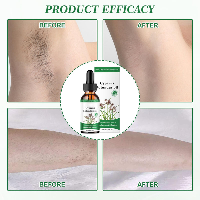 [Australia] - 1 Pcs Cyperus Rotundus Oil Cyperus Oil Cyperus Rotundus Cyperus Rotundus Oil Cyperus Oil for Hair Removal Cyprus Oil Reduces Hair Growth on the Body Suitable for All Skin Types 60 ml 