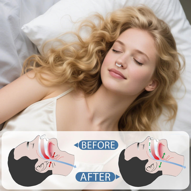 [Australia] - QUANROL Anti Snoring Devices, Silicone Nose Clip Stop Snoring, Snore Stopper Effective to Relieve Snoring, Snoring Solution Comfortable and Quieter Sleep, Clear 