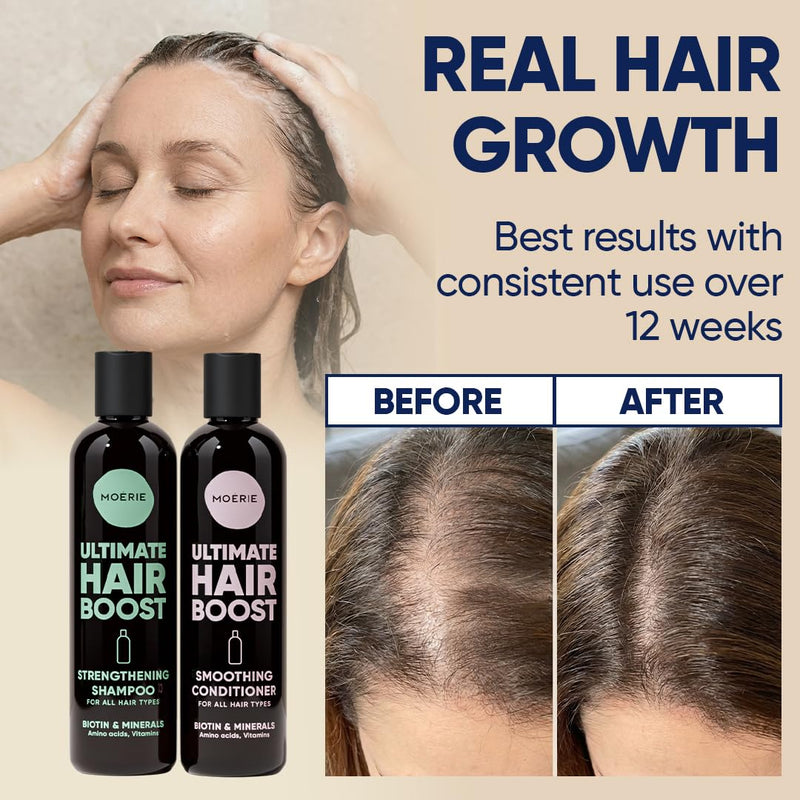 Moerie Hair Growth Shampoo and Conditioner for Women and Men, Hair Loss Solution with Biotin and Rosemary, Thickening Shampoo and Conditioner for Thinning Hair – Promotes Regrowth Single set