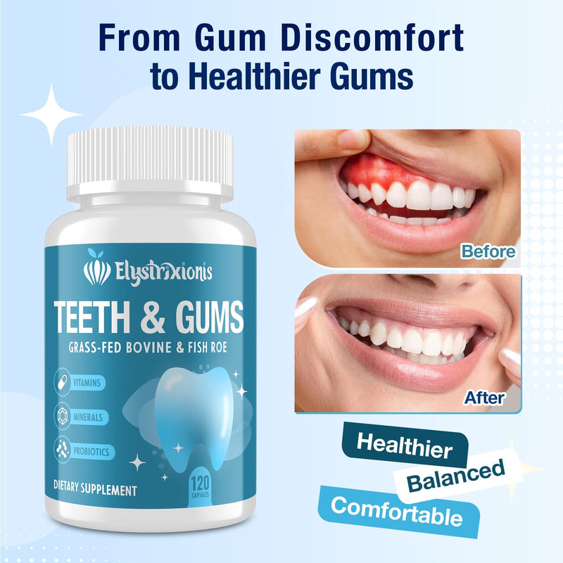 Gum Restore, Gum Repair for Receding Gums – Advanced Formula | 3B CFU Oral Probiotics, Vitamins D3, K2 & C | Supports Tooth Remineralization, Oral Balance & Fresh Breath | 240 Capsules 120 Count (Pack of 2)