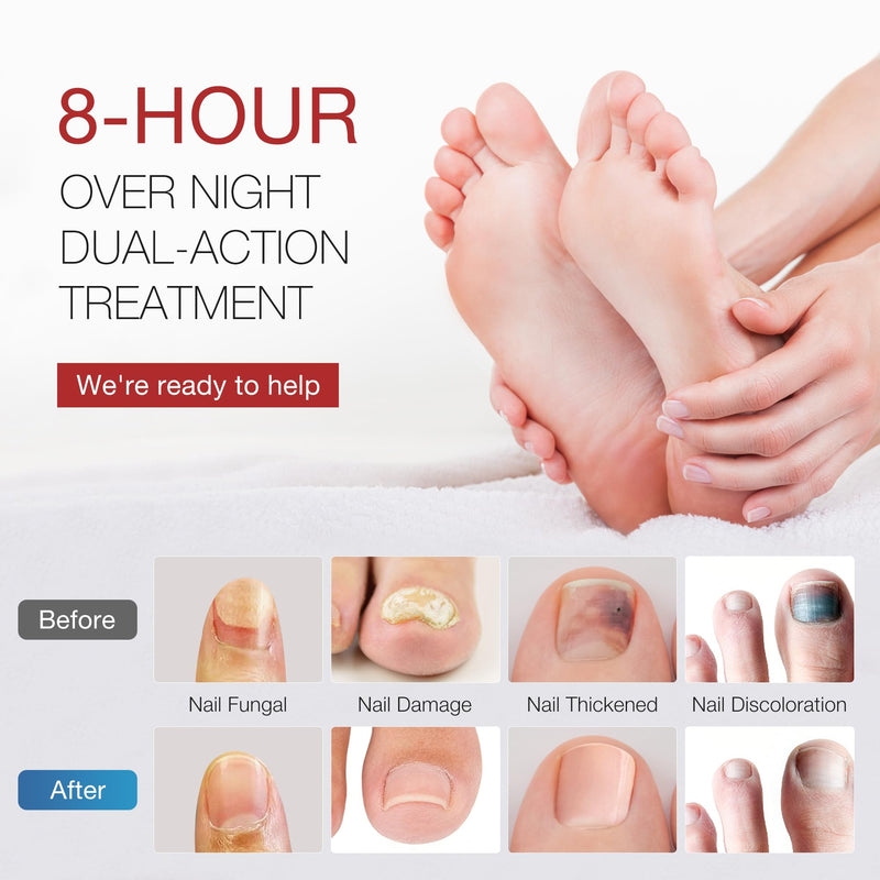Toenail Fungus Treatment Extra Strength - DR.RAPID Toenail Fungus Treatment Pen & Fungal Nail Patches, Day and Night Fungal Nail Treatment Set, Ideal for Nail Repair for Damaged Nails Toenail Fungus 0.1 Fl Oz (Pack of 20)