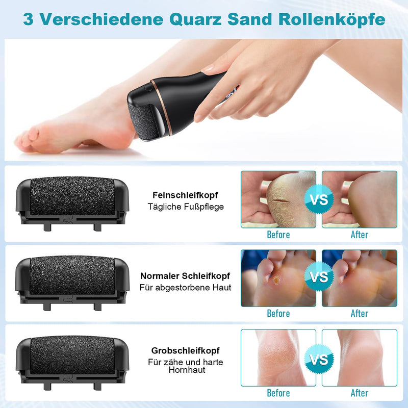 [Australia] - Callus Remover Electric - Callus Removal Foot Electric - Callus Planer Electric Feet with 2 Gears, IPX7 Waterproof Callus Remover for Cracked Heels, Dead Heels, Callus Removal Black 