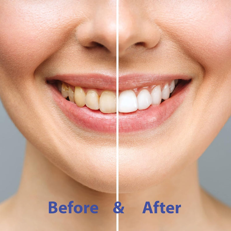 [Australia] - Chomp Super Whitening Toothpaste with Nano Hydroxyapatite 120 Tablet Refill 