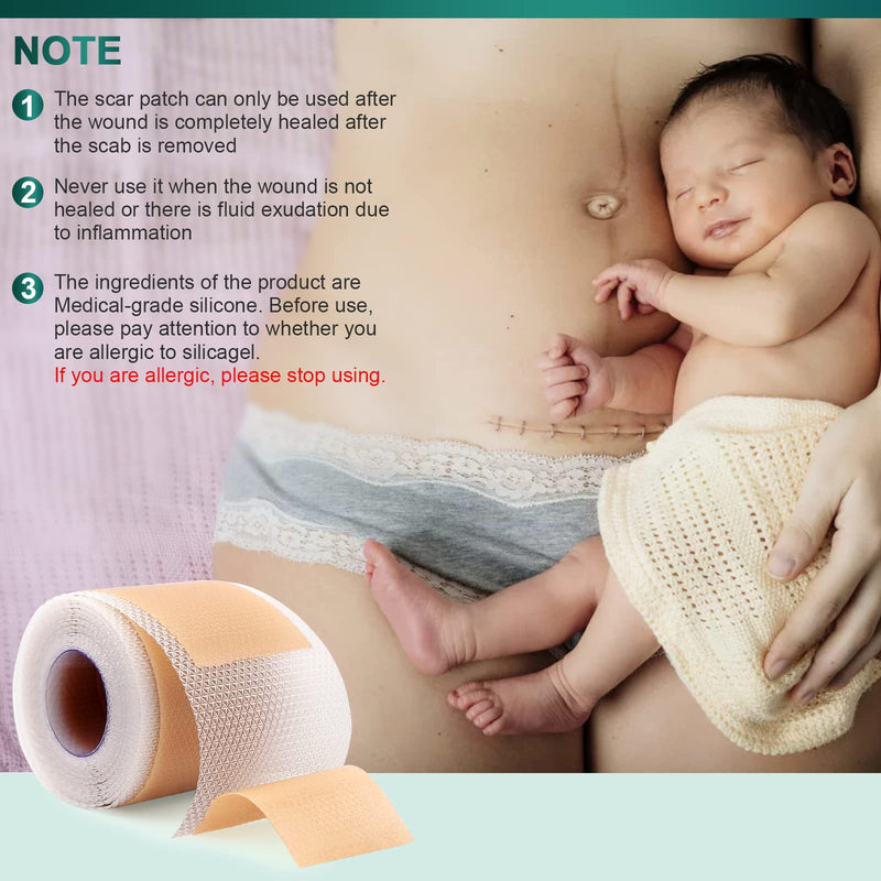[Australia] - Silicone Scar Sheets,Silicone Scar Tape(1.6"x 120" Roll-3M), Reusable and Effective Scar Removal Sheets, Silicone Scar Removal Sheets for Surgical Scars,Healing Keloid, C-Section, Tummy Tuck 1.6"x 120" Roll 