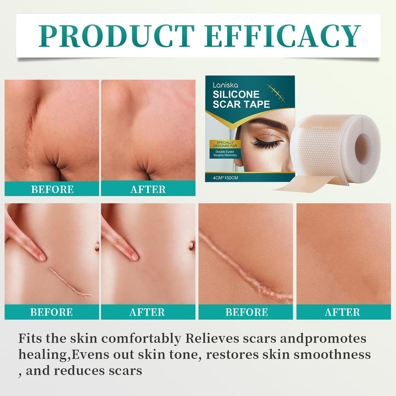 [Australia] - 1 Pcs Silicone Scar Tape Scar Plaster Silicone Scar Sheets Silicone Scar Plaster Silicone Plaster for Scars Scar Plaster Silicone Silicone Scar Tape Silicone Plaster Scar 4cm x150cm Roll 