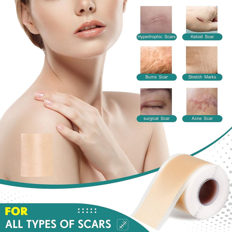 [Australia] - Silicone Scar Sheets, Silicone Scar Tape(1.6” x 120” Roll-3M), Scar Removal Away Strips for Surgical Scars, Keloid, C-Section, Burn et 120x1.6 Inch (Pack of 1) 
