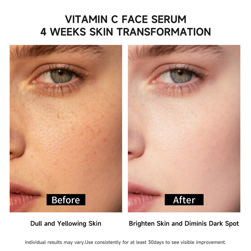 Vitamin C Face Serum with Glutathione, 4D Hyaluronic Acid & Aloe Vera – Lightweight Brightening & Hydrating Ampoule for Daily Skincare, Dark Spots, Sensitive Skin Friendly - (1.0 ml)*30 Vials