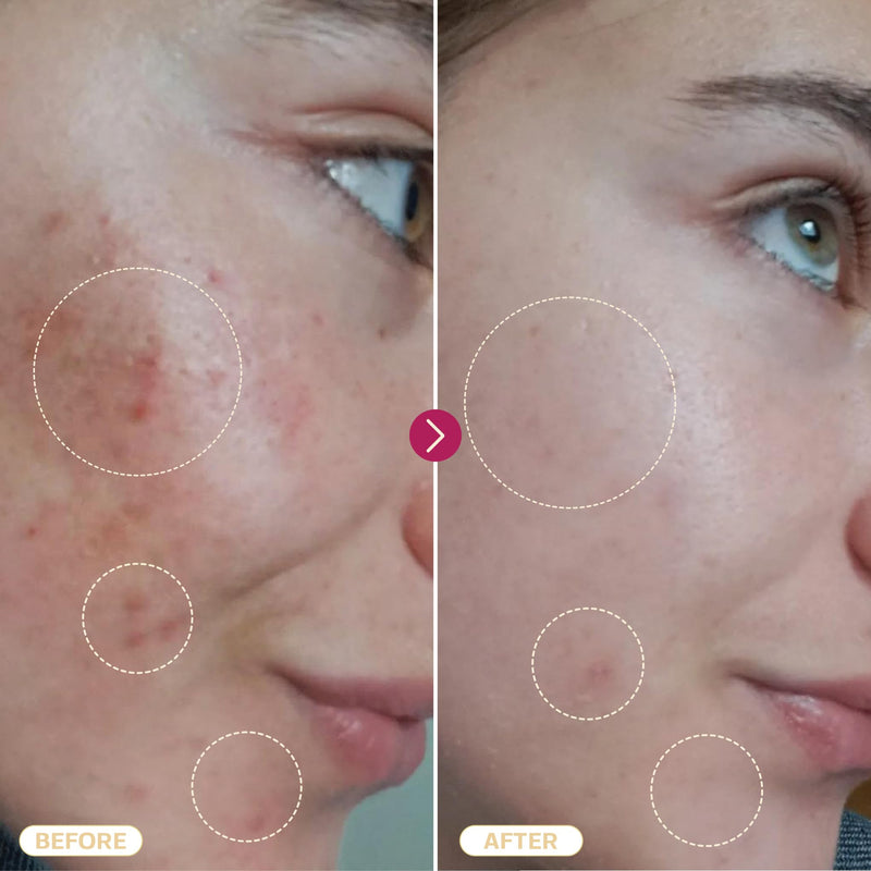 [Australia] - BASE LABORATORIES Hypochlorous Acid Spray | Skin healing for wounds | Spray solution for wound care, eczema, tattoo and piercing aftercare | Wound irrigation with saline solution Hypochlorous Acid | 240ml 240ml (pack of 1) 