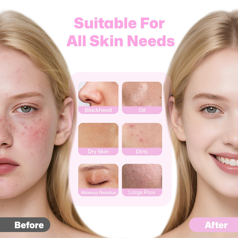 PRITECH Facial Cleansing Brush, Rechargeable Silicone Face Scrubber with Constant-Temperature Heating, Vibrating Exfoliator Scrubber for Deep Pore Cleaning, Waterproof Face Brush for Women & Men -Pink Pink