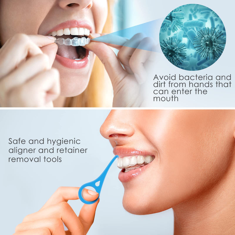 ARGOMAX - Aligner Removal Tool, 10 Invisible Braces Removal Tools, Retainer Remover Tool, Suitable for Removing Braces, Trays, Retainers, Dentures and Aligners(Blue). Regular size 10pcs Light blue