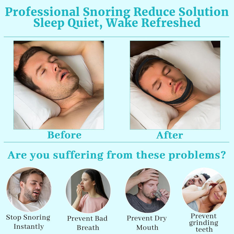[Australia] - Anti Snoring Chin Strap for Sleeping, 2 Pack Adjustable Jaw Support Strap to Keep Mouth Closed, Soft Snoring Solution for Men Women, Stops Snoring Dry Mouth, Comfort Fit Nighttime Sleeping Aid Black+blue L 