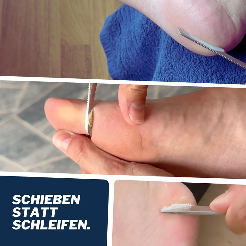 [Australia] - Mr. Fuss® Starter Kit 7-piece Edition Excell callus remover system package for gentle removal, including for manicures 