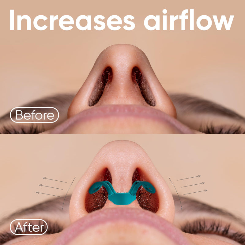 [Australia] - Brison Nasal Dilators - Nose Vents Opener for Better Breathing and Adults for Sleep and Activity Improves Airflow - 2pcs Soft-Hard Soft/Hard Turquoise Blue 
