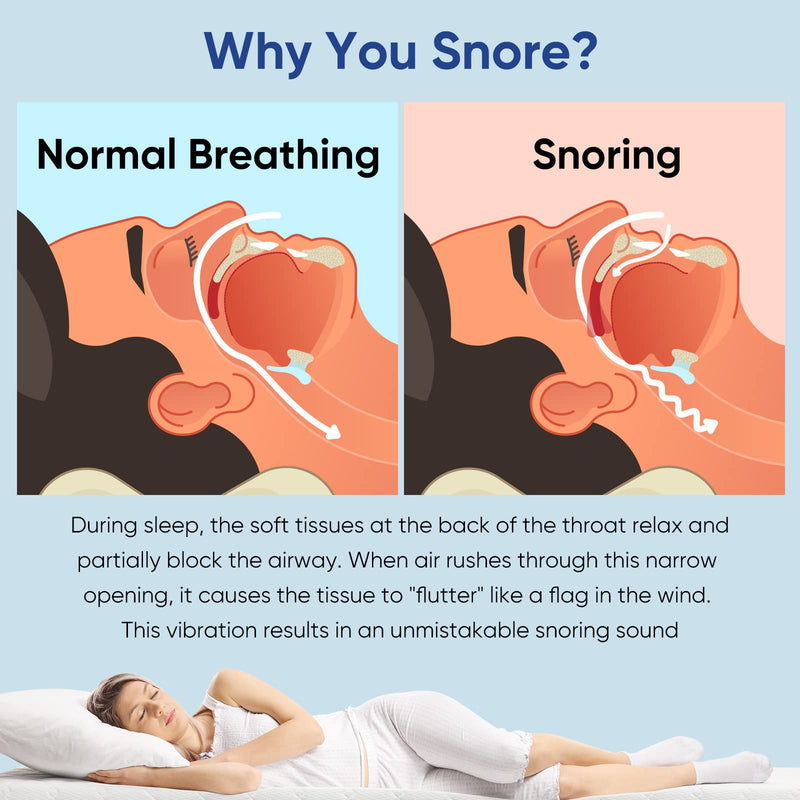 [Australia] - Bite splints, anti-snoring splint, effective snoring stopper mouthpiece bite splint night against teeth grinding and snoring men women 1 piece clear 