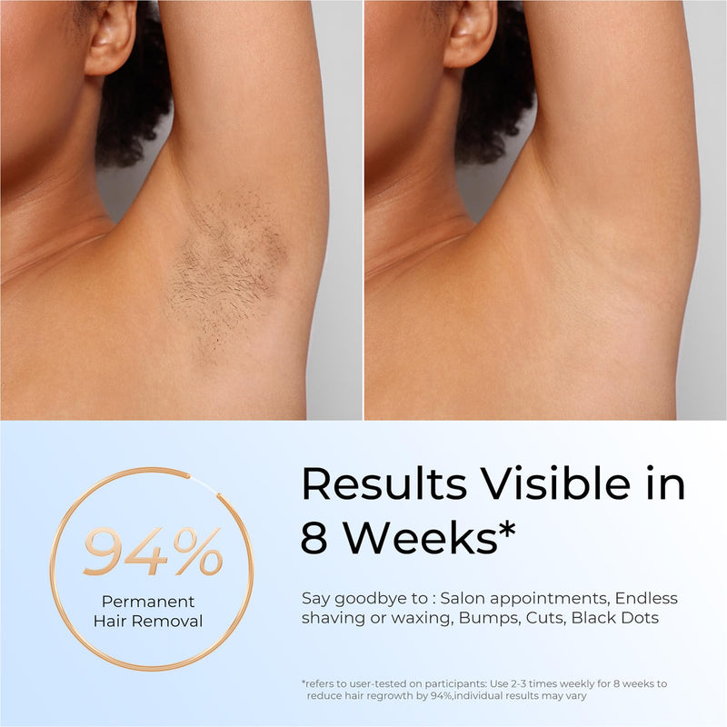 [Australia] - Laser Hair Removal, IPL Laser Hair Removal for Women and Men Permanent, Hair Removal Device with 3.0 IPL Red Light Wave, Home Laser Hair Removal Device for Facial Legs Armpits Bikini Body Use Gold White 