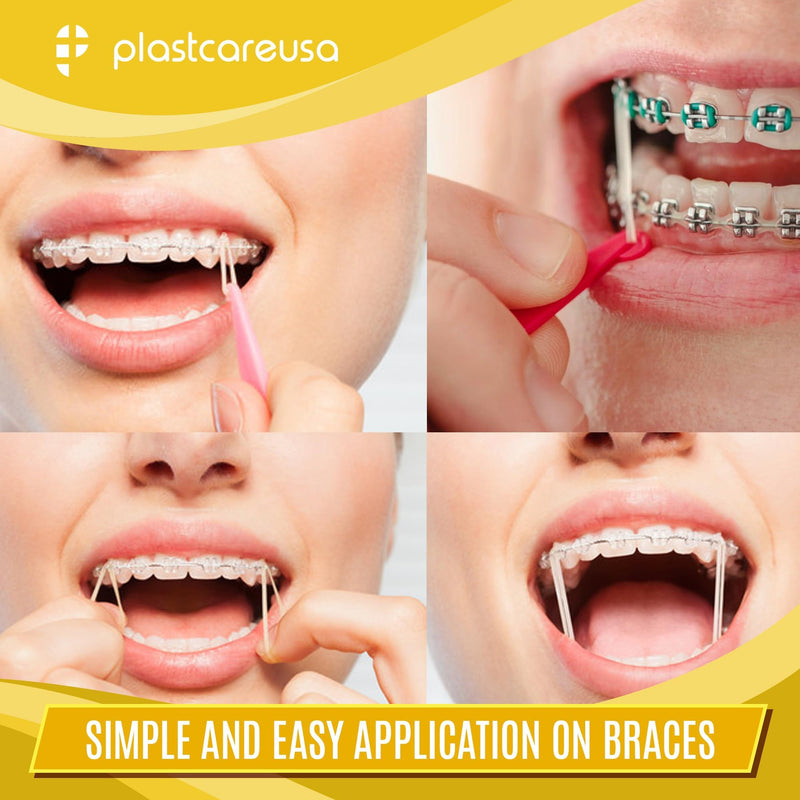 1000 (1/4" Fox, Medium 4.5 Oz) Orthodontic Latex Elastic Rubber Bands for Braces - Multi-Size Dental Elastics Kit, Heavy-Duty Ortho Bands for Gap Closure & Teeth Alignment (10 Bags of 100) 1/4" Fox