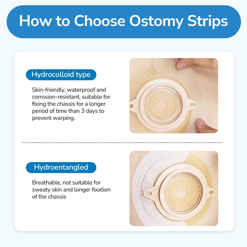 [Australia] - 20PCS Ostomy Barrier Strips, Skin-Friendly Hydrocolloid Skin Barrier Strips, Elastic Barrier Strips for Ostomy Bag Ostomy Colostomy Ileostomy Supplies 20pcs Ostomy Barrier Strips 
