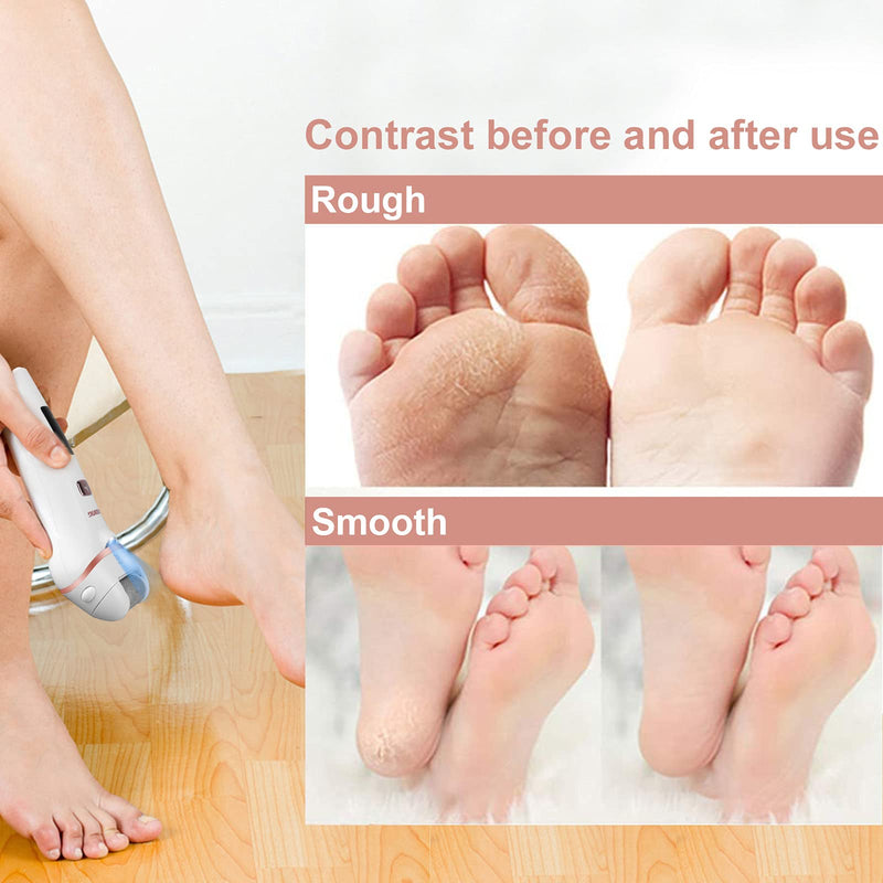 [Australia] - [3 pieces] Replacement rollers - Aottom professional replacement rollers for electric callus remover 3 types of roughness 3 pieces (pack of 1) 