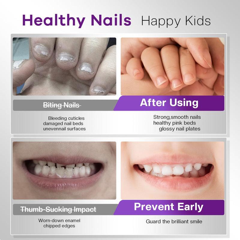 Glamonade Stop Nail Biting Polish Extra Strength Formula Upgraded Bitterness Effective Anti-Biting Treatment for Adults Kids Bitter Nail Deterrent to End Thumb Sucking Water Resistant & Long Lasting 0.5 Count (Pack of 1)