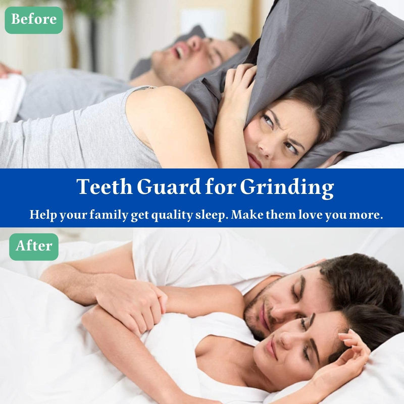 [Australia] - Mouth Guard for Clenching Teeth at Night, Night Guards for Teeth Grinding, Mouth Guard for Grinding Teeth at Night, Reusable Teeth Grinding Mouth Guard, Mouthguards for Grinding of Teeth (4 Piece Set) 