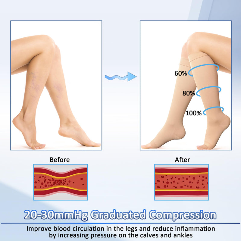 [Australia] - BellaAcht Medical Compression Stockings Women's 23-32 mmHg Compression Socks Graduated Support Support Stockings for Varicose Veins, Edema, Circulation Promotion M Beige 