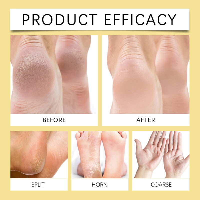 [Australia] - Crack Feet Prevention Stick, Heel Cream For Dry Cracked Feet, Foot Care Cream Moisturizing Foot Balm, Remove Dead Skin And Softening Dry Skin (Pink+Blue) Pink+Blue 