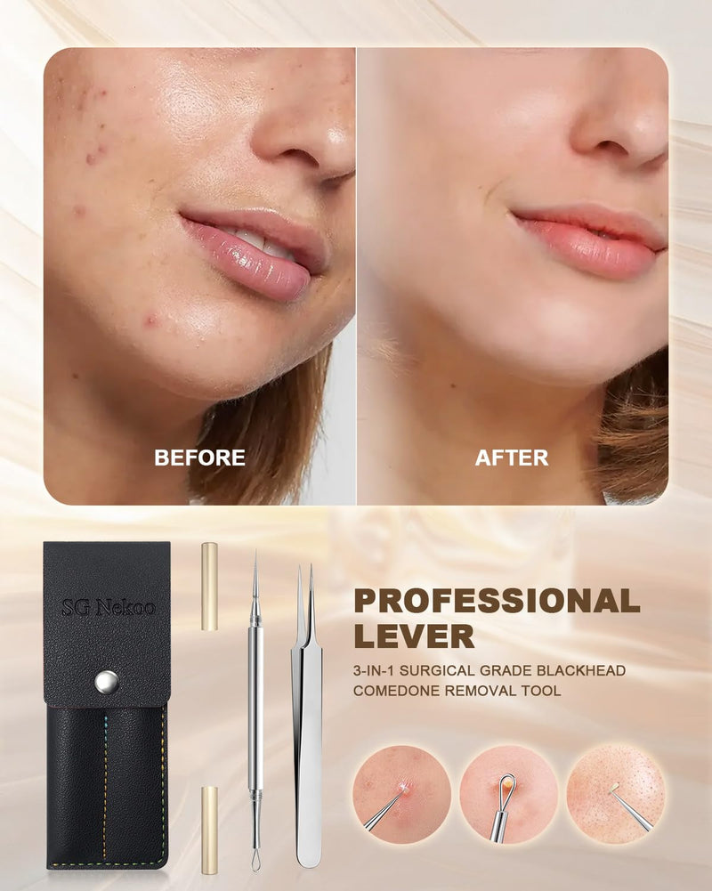 [Australia] - SGNEKOO Professional Facial Milia Removal Tool and Whitehead Extractor,Titanium Alloy Double Ended Needle and Steel Tweezers Kit,Blackhead,Blemish,Zit and Pimple Acne Remover Popper (Titanium Gold) Titanium Gold 