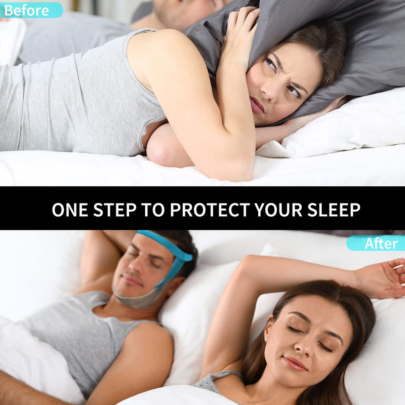 [Australia] - Anti Snoring Chin Strap for Men and Women, Comfortable Chin Strap for Cpap Users, Adjustable Stop Snoring Chin Strap Snoring Solution Chin Straps to Keep Mouth Closed While Sleeping (Blue) Blue 2 