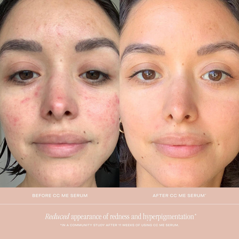 Summer Fridays CC Me Face Serum with Vitamin C & Niacinamide (1 Fl Oz) | Brightening & Hydrating Vitamin C Serum for Face, Improves Skin Tone & Helps Reduce Appearance of Dark Spots Over Time