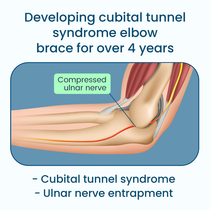 [Australia] - Cubital Tunnel Syndrome Elbow Brace Splint For Ulnar Nerve Entrapment Black L 