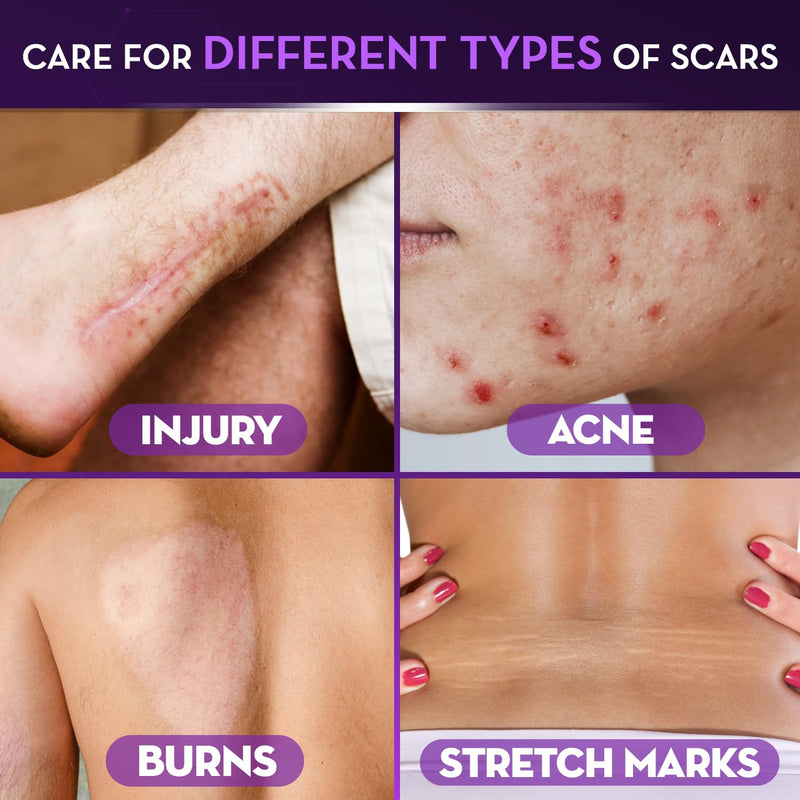 [Australia] - Cicatricure Advanced Scar Gel for Face & Body - Proven Results in 2 Weeks, Scar Treatment for Surgical Scars, Stretch Marks, Scars of Burns and Injuries, Acne Scar Treatment, 1 oz (28 g) Face & Body Scar Gel, 1oz 